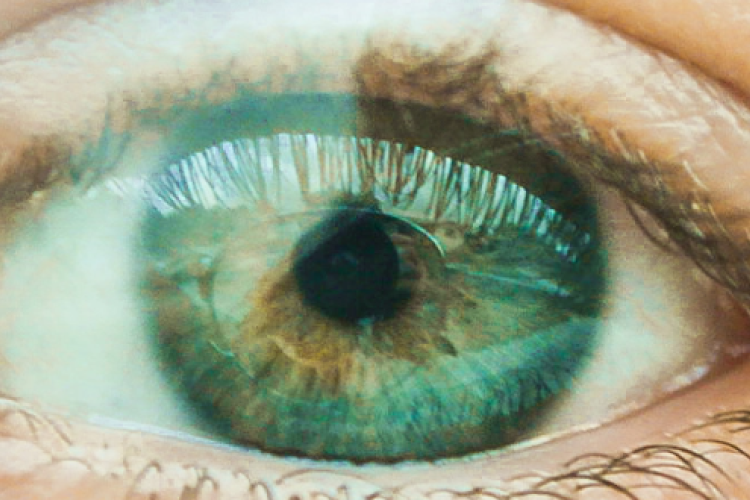 eye